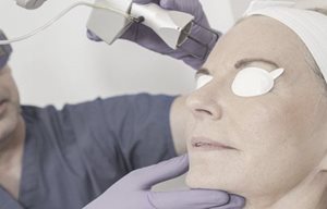Kvinna som går en laserbehandling i ansiktet.