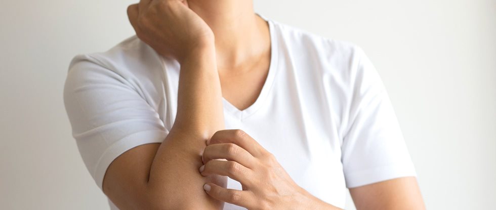 An eczema rash is one sign of an eczema flare up