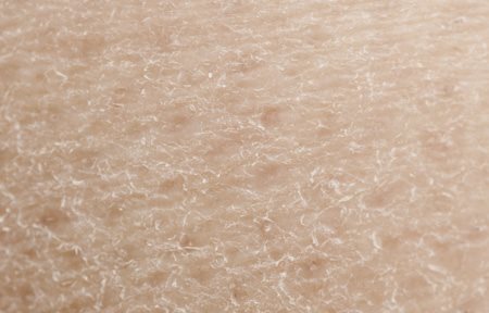 Närbild av torr hud